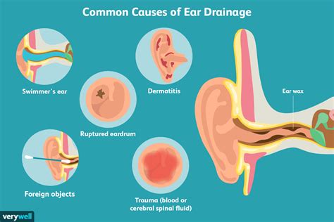 ear leaking clear fluid no pain|Ear Discharge: Causes, Treatments, and Prevention